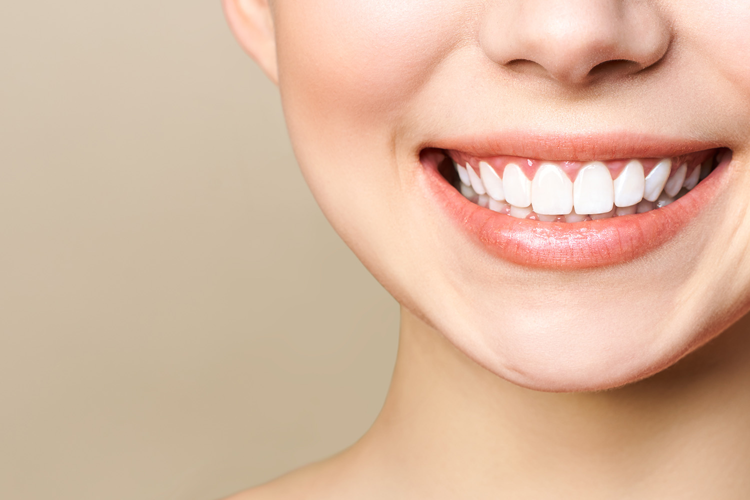 ダイレクトボンディング