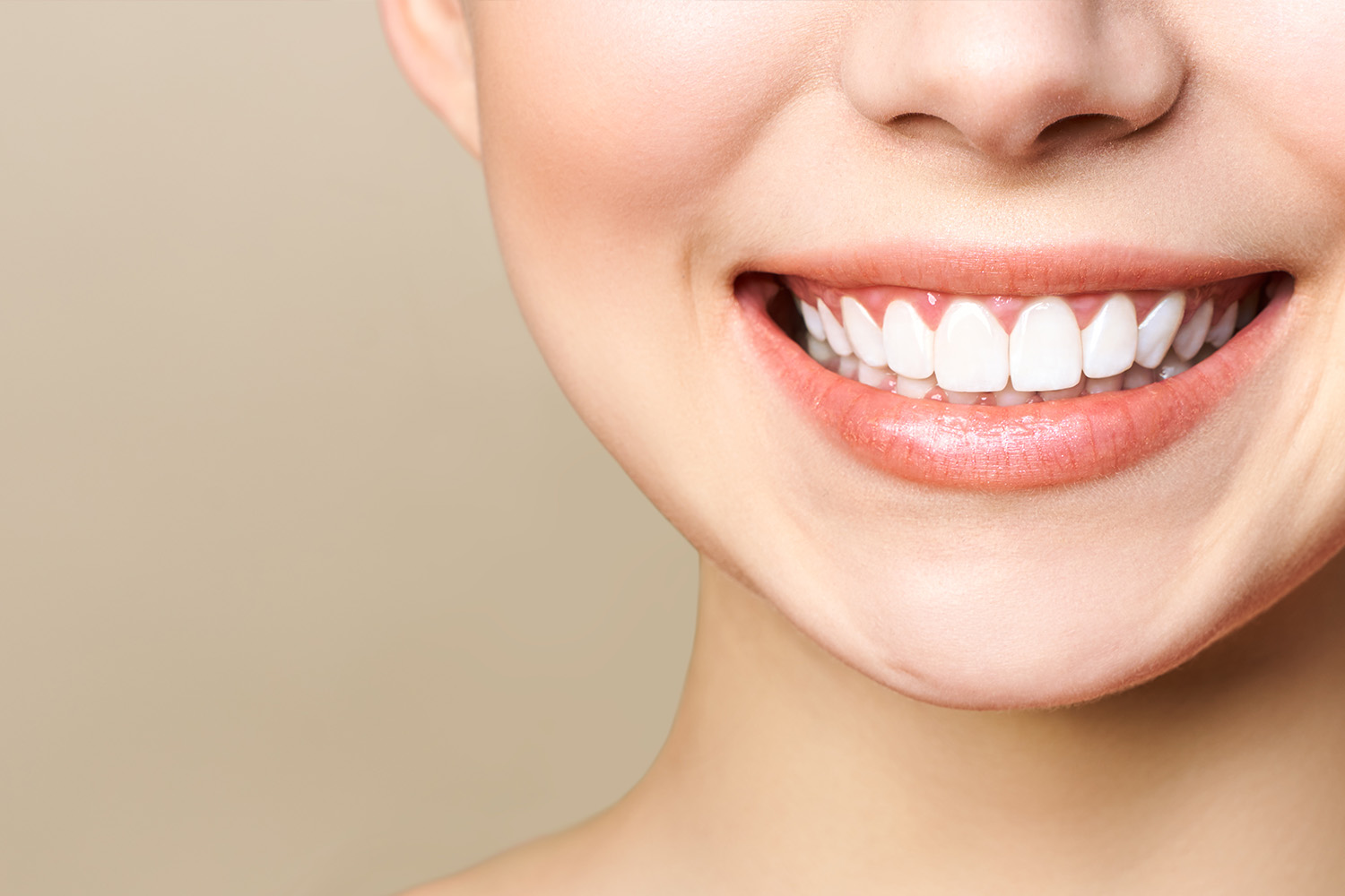 ダイレクトボンディングとは