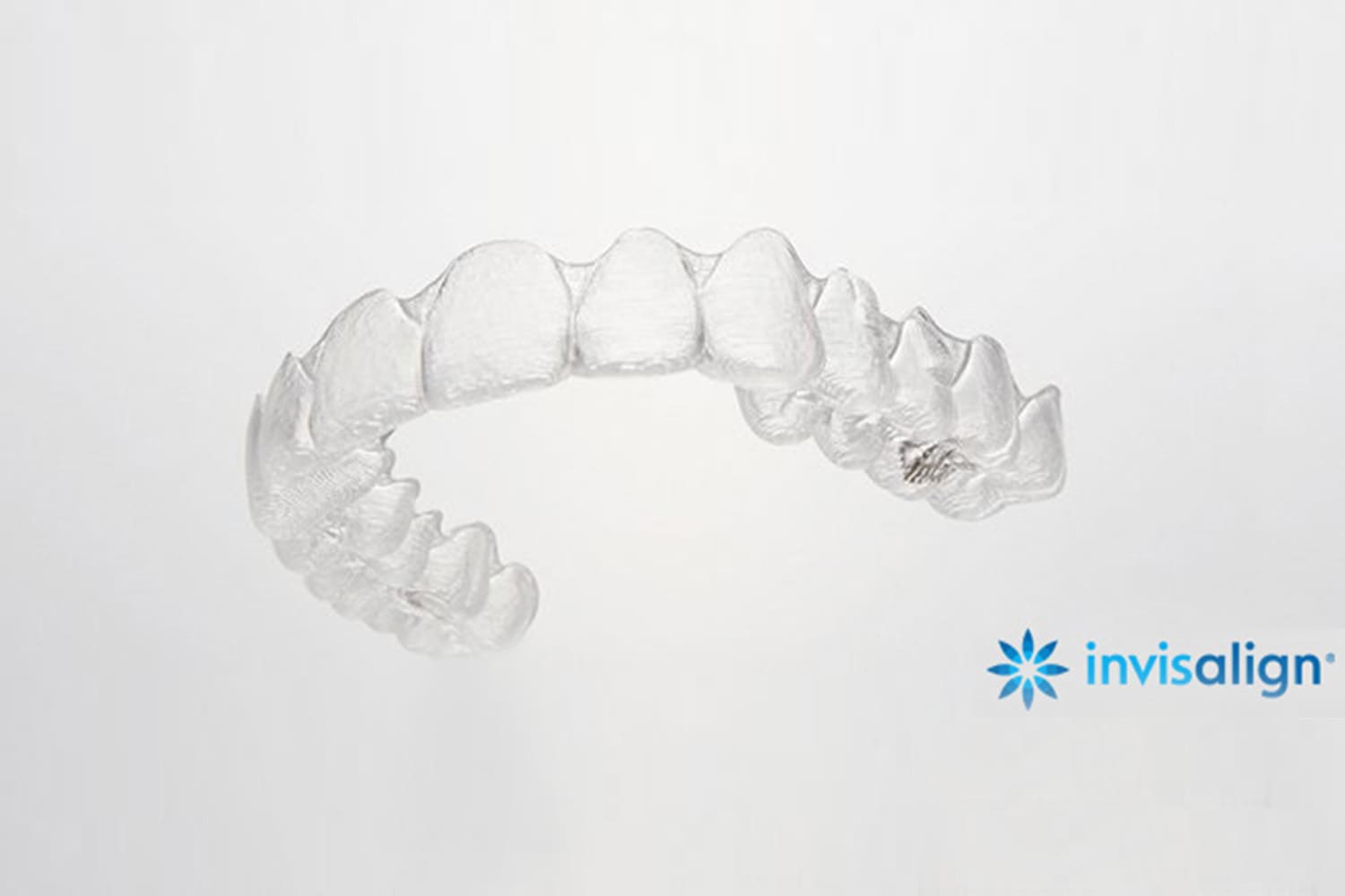 マウスピース型矯正（インビザライン）