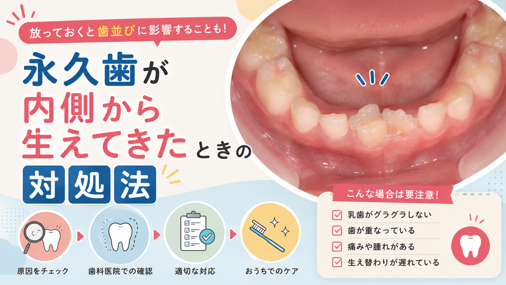 【院長ブログ】永久歯が内側から生えてきたときの対処法